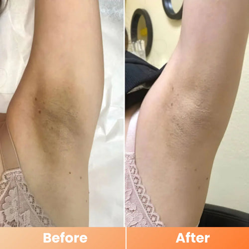 Dr. Melaxin Peel Shot Spay 200ml – Stop Hiding Your Skin. Start Showing It Off. ✅