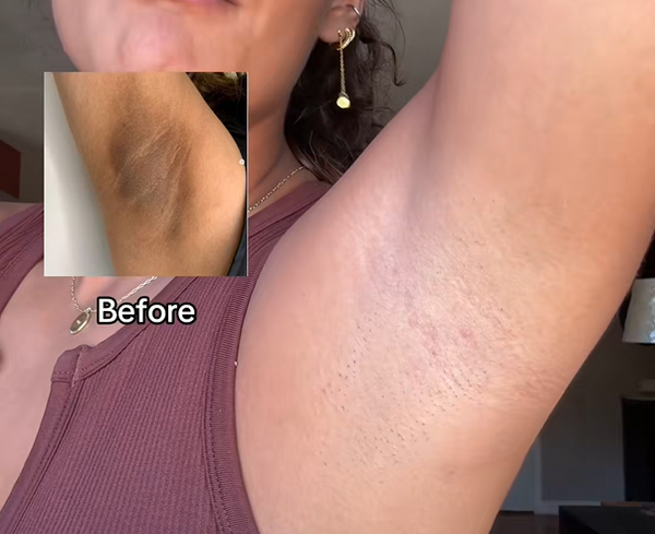 Dr. Melaxin Peel Shot Keratin Care Kojic Acid Turmeric Spray 200ml