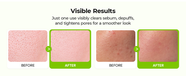 Dr.Melaxin Cactox Exfoliating Peel Shot Serum