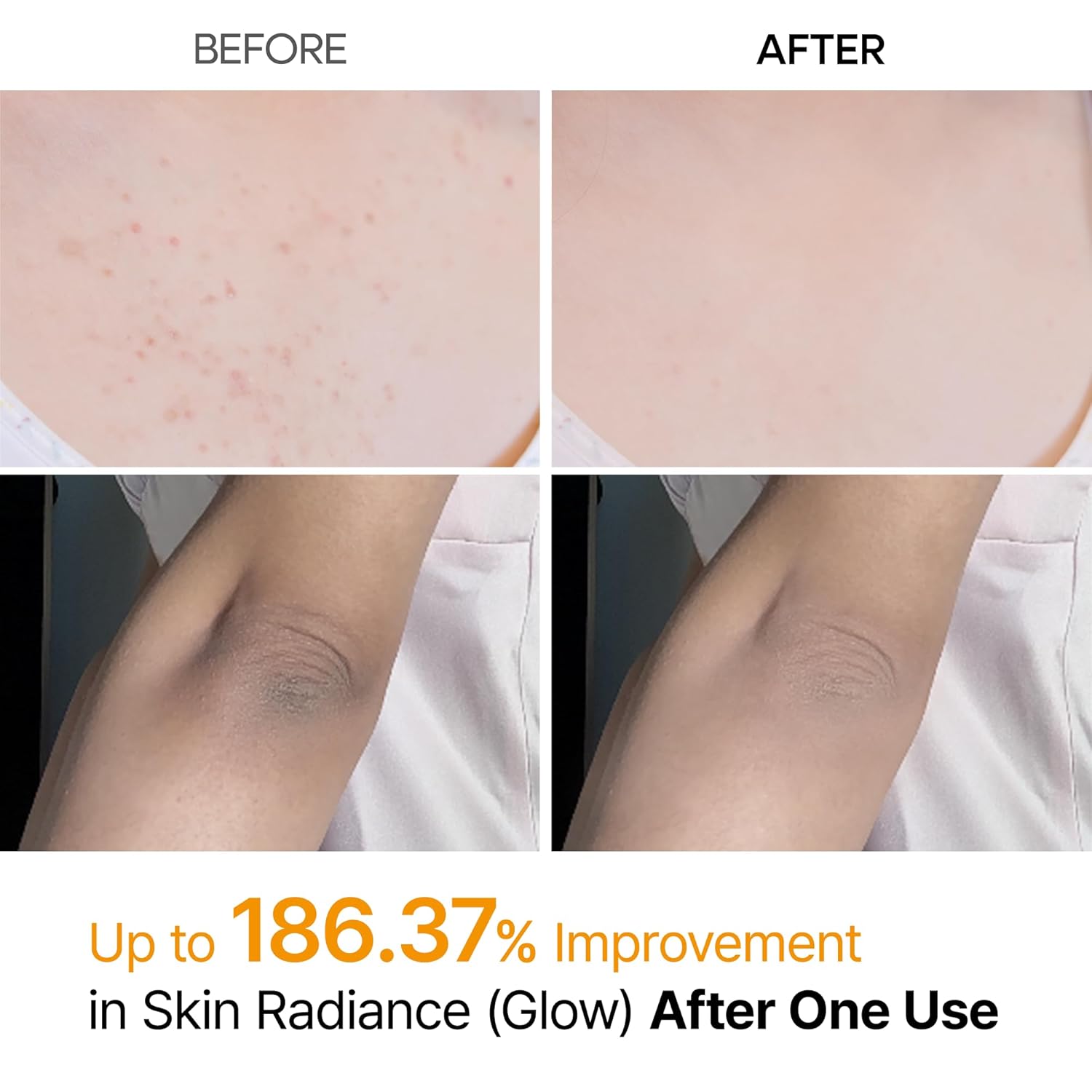 Dr. Melaxin Peel Shot Spay 200ml – Stop Hiding Your Skin. Start Showing It Off. ✅